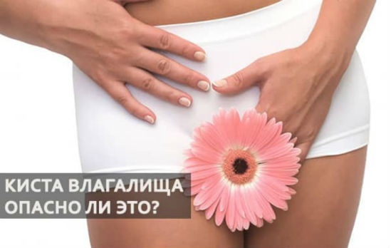 Киста во влагалище: причины, лечение, удаление 